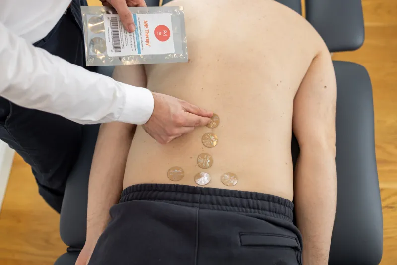 ANF Therapy korongok felhelyezése a gerincre